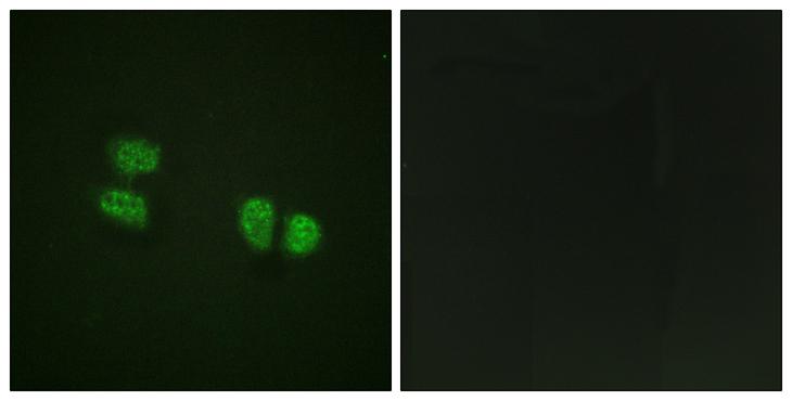 DDX5 Antibody - P-peptide - + Immunofluorescence analysis of HeLa cells, using DDX5/DEAD-box Protein 5 (Phospho-Tyr593) antibody.
