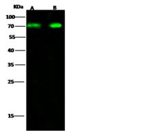 DDX5 Antibody - Anti-DDX5 rabbit polyclonal antibody at 1:500 dilution. Lane A: HeLa Whole Cell Lysate. Lane B: PC12 Whole Cell Lysate. Lysates/proteins at 30 ug per lane. Secondary: Goat Anti-Rabbit IgG H&L (Dylight 800) at 1/10000 dilution. Developed using the Odyssey technique. Performed under reducing conditions. Predicted band size: 69 kDa. Observed band size: 70 kDa.