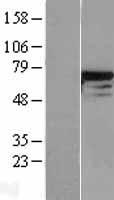 DDX5 Protein - Western validation with an anti-DDK antibody * L: Control HEK293 lysate R: Over-expression lysate