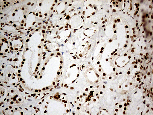 DDX50 Antibody - Immunohistochemical staining of paraffin-embedded Human Kidney tissue within the normal limits using anti-DDX50 mouse monoclonal antibody. (Heat-induced epitope retrieval by 1mM EDTA in 10mM Tris buffer. (pH8.5) at 120°C for 3 min. (1:1000)