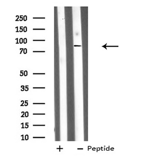 DDX50 Antibody - Western blot analysis of DDX50 expression in mouse lung lysate 