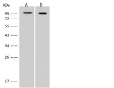 DDX50 Antibody - Anti-DDX50 rabbit polyclonal antibody at 1:500 dilution. Lane A: HeLa Whole Cell Lysate. Lane B: Jurkat Whole Cell Lysate. Lysates/proteins at 30 ug per lane. Secondary: Goat Anti-Rabbit IgG (H+L)/HRP at 1/10000 dilution. Developed using the ECL technique. Performed under reducing conditions. Predicted band size: 83 kDa. Observed band size: 95 kDa.