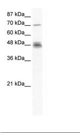 DDX50 Antibody - Jurkat Cell Lysate.  This image was taken for the unconjugated form of this product. Other forms have not been tested.