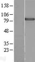DDX50 Protein - Western validation with an anti-DDK antibody * L: Control HEK293 lysate R: Over-expression lysate