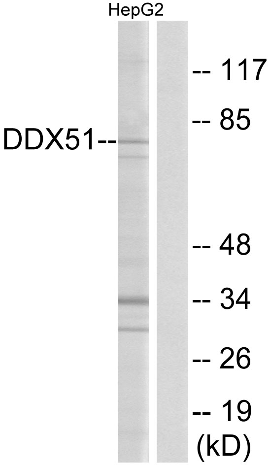 DDX51 Antibody - Western blot analysis of lysates from HepG2 cells, using DDX51 Antibody. The lane on the right is blocked with the synthesized peptide.