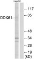 DDX51 Antibody - Western blot analysis of lysates from HepG2 cells, using DDX51 Antibody. The lane on the right is blocked with the synthesized peptide.