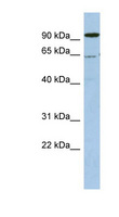 DDX52 Antibody - DDX52 antibody Western blot of OVCAR-3 cell lysate. This image was taken for the unconjugated form of this product. Other forms have not been tested.