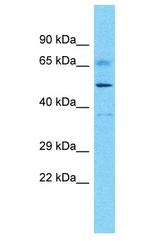 DDX52 Antibody - DDX52 antibody Western Blot of Uterus tumor. Antibody dilution: 1 ug/ml.  This image was taken for the unconjugated form of this product. Other forms have not been tested.