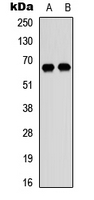 DDX52 Antibody - Western blot analysis of DDX52 expression in HEK293T (A); Raji (B) whole cell lysates.