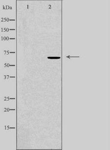 DDX52 Antibody - Western blot analysis of extracts of HepG2 cells using DDX52 antibody. The lane on the left is treated with the antigen-specific peptide.