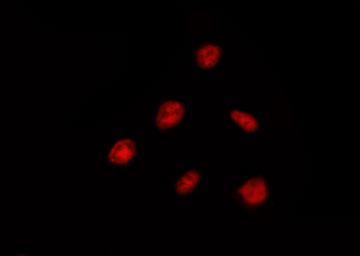 DDX52 Antibody - Staining HeLa cells by IF/ICC. The samples were fixed with PFA and permeabilized in 0.1% Triton X-100, then blocked in 10% serum for 45 min at 25°C. The primary antibody was diluted at 1:200 and incubated with the sample for 1 hour at 37°C. An Alexa Fluor 594 conjugated goat anti-rabbit IgG (H+L) Ab, diluted at 1/600, was used as the secondary antibody.