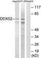 DDX52 Antibody - Western blot analysis of extracts from HepG2 cells and HT-29 cells, using DDX52 antibody.