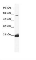 DDX55 Antibody - Jurkat Cell Lysate.  This image was taken for the unconjugated form of this product. Other forms have not been tested.