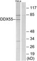 DDX55 Antibody - Western blot analysis of lysates from HeLa cells, using DDX55 Antibody. The lane on the right is blocked with the synthesized peptide.