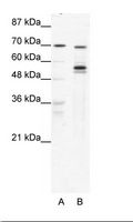 DDX55 Antibody - A: Marker, B: HepG2 Cell Lysate.  This image was taken for the unconjugated form of this product. Other forms have not been tested.