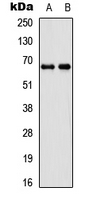 DDX55 Antibody - Western blot analysis of DDX55 expression in SHSY5Y (A); 293T (B) whole cell lysates.