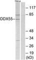 DDX55 Antibody - Western blot analysis of extracts from HeLa cells, using DDX55 antibody.