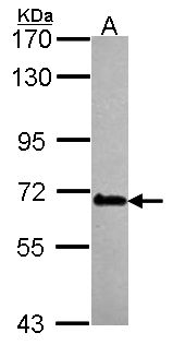 DDX56 Antibody - Sample (30 ug of whole cell lysate). A: Hela. 7.5% SDS PAGE. DDX56 antibody diluted at 1:1000.