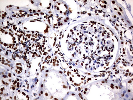 DDX56 Antibody - IHC of paraffin-embedded Human Kidney tissue using anti-DDX56 mouse monoclonal antibody. (Heat-induced epitope retrieval by 10mM citric buffer, pH6.0, 120°C for 3min).
