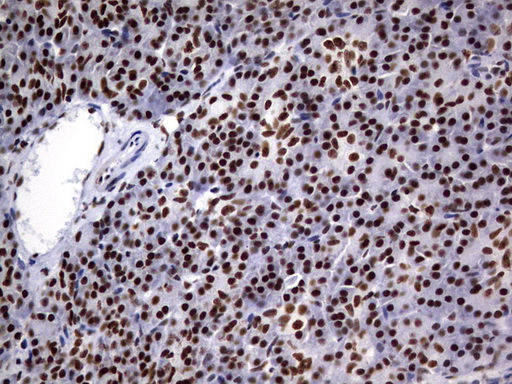 DDX56 Antibody - IHC of paraffin-embedded Human pancreas tissue using anti-DDX56 mouse monoclonal antibody. (Heat-induced epitope retrieval by 10mM citric buffer, pH6.0, 120°C for 3min).