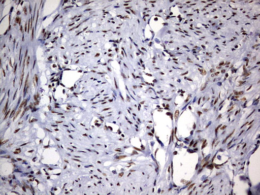 DDX56 Antibody - IHC of paraffin-embedded Human endometrium tissue using anti-DDX56 mouse monoclonal antibody. (Heat-induced epitope retrieval by 10mM citric buffer, pH6.0, 120°C for 3min).