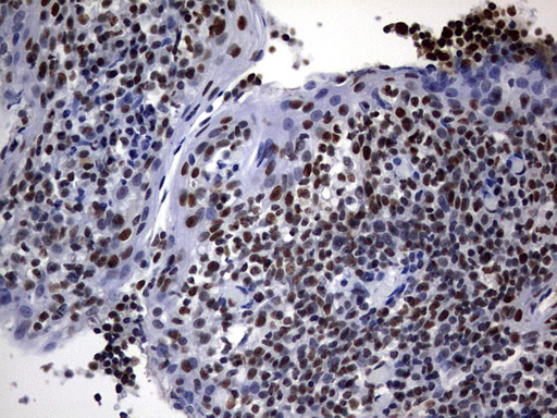 DDX56 Antibody - IHC of paraffin-embedded Human tonsil using anti-DDX56 mouse monoclonal antibody. (Heat-induced epitope retrieval by 10mM citric buffer, pH6.0, 120°C for 3min).