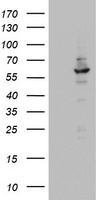 DDX56 Antibody - HEK293T cells were transfected with the pCMV6-ENTRY control (Left lane) or pCMV6-ENTRY DDX56 (Right lane) cDNA for 48 hrs and lysed. Equivalent amounts of cell lysates (5 ug per lane) were separated by SDS-PAGE and immunoblotted with anti-DDX56.
