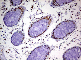 DDX56 Antibody - IHC of paraffin-embedded Human colon tissue using anti-DDX56 mouse monoclonal antibody. (Heat-induced epitope retrieval by 10mM citric buffer, pH6.0, 120°C for 3min).