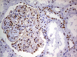 DDX56 Antibody - IHC of paraffin-embedded Human Kidney tissue using anti-DDX56 mouse monoclonal antibody. (Heat-induced epitope retrieval by 10mM citric buffer, pH6.0, 120°C for 3min).