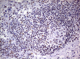 DDX56 Antibody - IHC of paraffin-embedded Human tonsil using anti-DDX56 mouse monoclonal antibody. (Heat-induced epitope retrieval by 10mM citric buffer, pH6.0, 120°C for 3min).