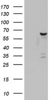 DDX56 Antibody - HEK293T cells were transfected with the pCMV6-ENTRY control (Left lane) or pCMV6-ENTRY DDX56 (Right lane) cDNA for 48 hrs and lysed. Equivalent amounts of cell lysates (5 ug per lane) were separated by SDS-PAGE and immunoblotted with anti-DDX56.