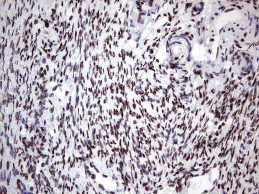 DDX56 Antibody - Immunohistochemical staining of paraffin-embedded Human Ovary tissue using anti-DDX56 mouse monoclonal antibody.  heat-induced epitope retrieval by 1 mM EDTA in 10mM Tris, pH9.0, 120C for 3min)
