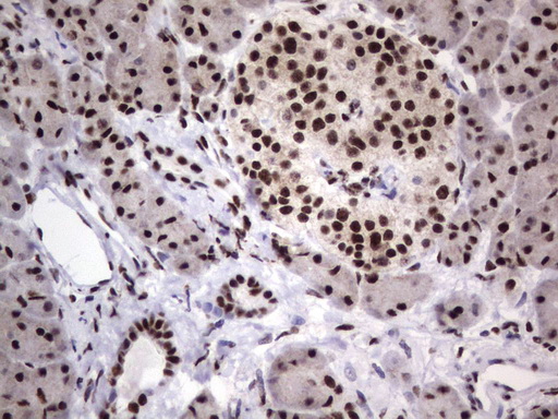 DDX56 Antibody - Immunohistochemical staining of paraffin-embedded Human pancreas tissue using anti-DDX56 mouse monoclonal antibody.  heat-induced epitope retrieval by 1 mM EDTA in 10mM Tris, pH9.0, 120C for 3min)