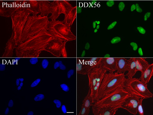 DDX56 Antibody - Immunofluorescent staining of HeLa cells using anti-DDX56 mouse monoclonal antibody  green, 1:100). Actin filaments were labeled with Alexa Fluor® 594 Phalloidin. (red), and nuclear with DAPI. (blue). Scale bar, 20µm.