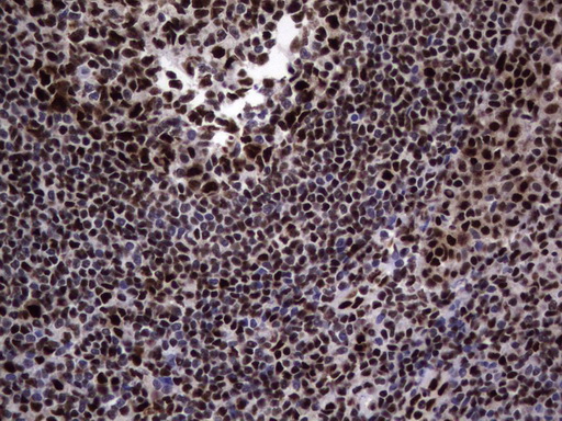 DDX56 Antibody - Immunohistochemical staining of paraffin-embedded Human tonsil using anti-DDX56 mouse monoclonal antibody.  heat-induced epitope retrieval by 1 mM EDTA in 10mM Tris, pH9.0, 120C for 3min)
