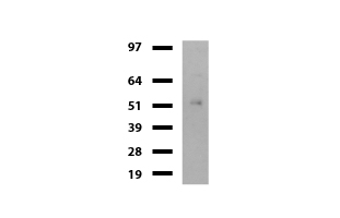 DDX56 Antibody - Western blot of mouse tissue lysates. (20ug) from Spleen. Primary antibody diluation: 1:500. Secondary antibody dilution: Mouse TrueBlot® Ultra. (1:1000).