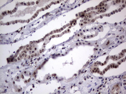 DDX56 Antibody - Immunohistochemical staining of paraffin-embedded Human Kidney tissue using anti-DDX56 mouse monoclonal antibody.  heat-induced epitope retrieval by 1 mM EDTA in 10mM Tris, pH9.0, 120C for 3min)