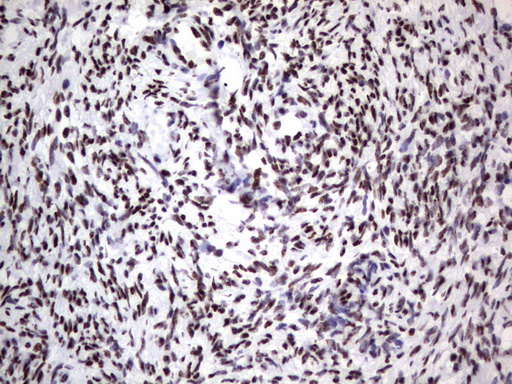 DDX56 Antibody - Immunohistochemical staining of paraffin-embedded Human Ovary tissue using anti-DDX56 mouse monoclonal antibody.  heat-induced epitope retrieval by 1 mM EDTA in 10mM Tris, pH9.0, 120C for 3min)