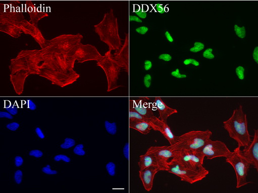 DDX56 Antibody - Immunofluorescent staining of HeLa cells using anti-DDX56 mouse monoclonal antibody  green, 1:50). Actin filaments were labeled with Alexa Fluor® 594 Phalloidin. (red), and nuclear with DAPI. (blue). Scale bar, 20µm.