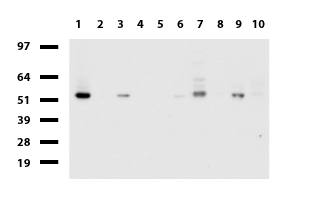 DDX56 Antibody - Western blot of human tissue lysates. (15ug) from 10 different tissues. (1: Testis, 2: Omentum, 3: Uterus, 4: Breast, 5: Brain, 6: Liver, 7: Ovary, 8: Thyroid, 9: Colon, 10: Spleen ). Diluation: 1:500.