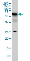DDX56 Antibody - DDX56 monoclonal antibody (M05), clone 4C5 Western blot of DDX56 expression in HeLa.