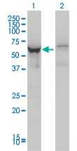DDX56 Antibody - Western blot of DDX56 expression in transfected 293T cell line by DDX56 monoclonal antibody (M05), clone 4C5.