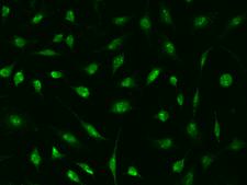 DDX56 Antibody - Immunofluorescence staining of DDX56 in Hela cells. Cells were fixed with 4% PFA, permeabilzed with 0.1% Triton X-100 in PBS, blocked with 10% serum, and incubated with rabbit anti-Human DDX56 polyclonal antibody (dilution ratio 1:1000) at 4°C overnight. Then cells were stained with the Alexa Fluor 488-conjugated Goat Anti-rabbit IgG secondary antibody (green). Positive staining was localized to Nucleus.