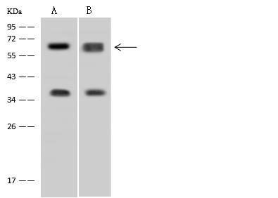 DDX56 Antibody - Anti-DDX56 rabbit polyclonal antibody at 1:500 dilution. Lane A: HepG2 Whole Cell Lysate. Lane B: U-251 MG Whole Cell Lysate. Lysates/proteins at 30 ug per lane. Secondary: Goat Anti-Rabbit IgG (H+L)/HRP at 1/10000 dilution. Developed using the ECL technique. Performed under reducing conditions. Predicted band size: 61 kDa. Observed band size: 61 kDa.