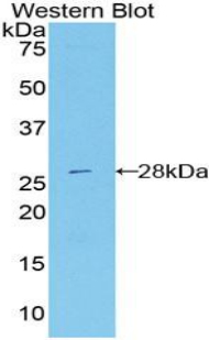DDX58 / RIG-1 / RIG-I Antibody - Western blot of recombinant DDX58 / RIG-1 / RIG-I.  This image was taken for the unconjugated form of this product. Other forms have not been tested.
