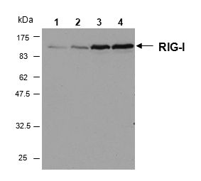 DDX58 / RIG-1 / RIG-I Antibody - Western blot analysis of human RIG-I in HeLa cells by using RIG-I, mAb (Alme-1) . Method: Cell extracts from HeLa cells either unstimulated (lane 1) or stimulated for 6h (lane 2), 16h (lane 3) or 24 h (lane 4) with Interferon gamma were resolved by SDS-PAGE under reducing conditions, transferred to nitrocellulose and incubated with the RIG-I , mAb (Alme-1) at a 1:1000 dilution for 1 hour. Proteins were visualized using a peroxidase-conjugated polyclonal antibody to mouse IgG and a chemiluminescence detection system.  This image was taken for the unconjugated form of this product. Other forms have not been tested.