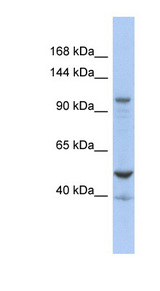 DDX58 / RIG-1 / RIG-I Antibody - DDX58 antibody Western blot of OVCAR-3 cell lysate. This image was taken for the unconjugated form of this product. Other forms have not been tested.