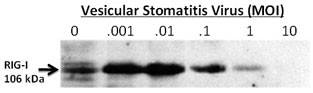 DDX58 / RIG-1 / RIG-I Antibody - 24-hour post infection immunoblots of whole cell lysates from primary murine microglia cells (2x106) untreated (0) or exposed to vesicular stomatitis virus at a range of viral particle/cell ratios. Data courtesy of Dr. Samantha Furr, University of North Carolina at Charlotte.