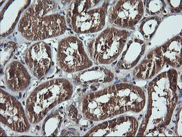 DDX58 / RIG-1 / RIG-I Antibody - IHC of paraffin-embedded Human Kidney tissue using anti-DDX58 mouse monoclonal antibody.
