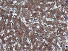 DDX58 / RIG-1 / RIG-I Antibody - IHC of paraffin-embedded Human liver tissue using anti-DDX58 mouse monoclonal antibody.